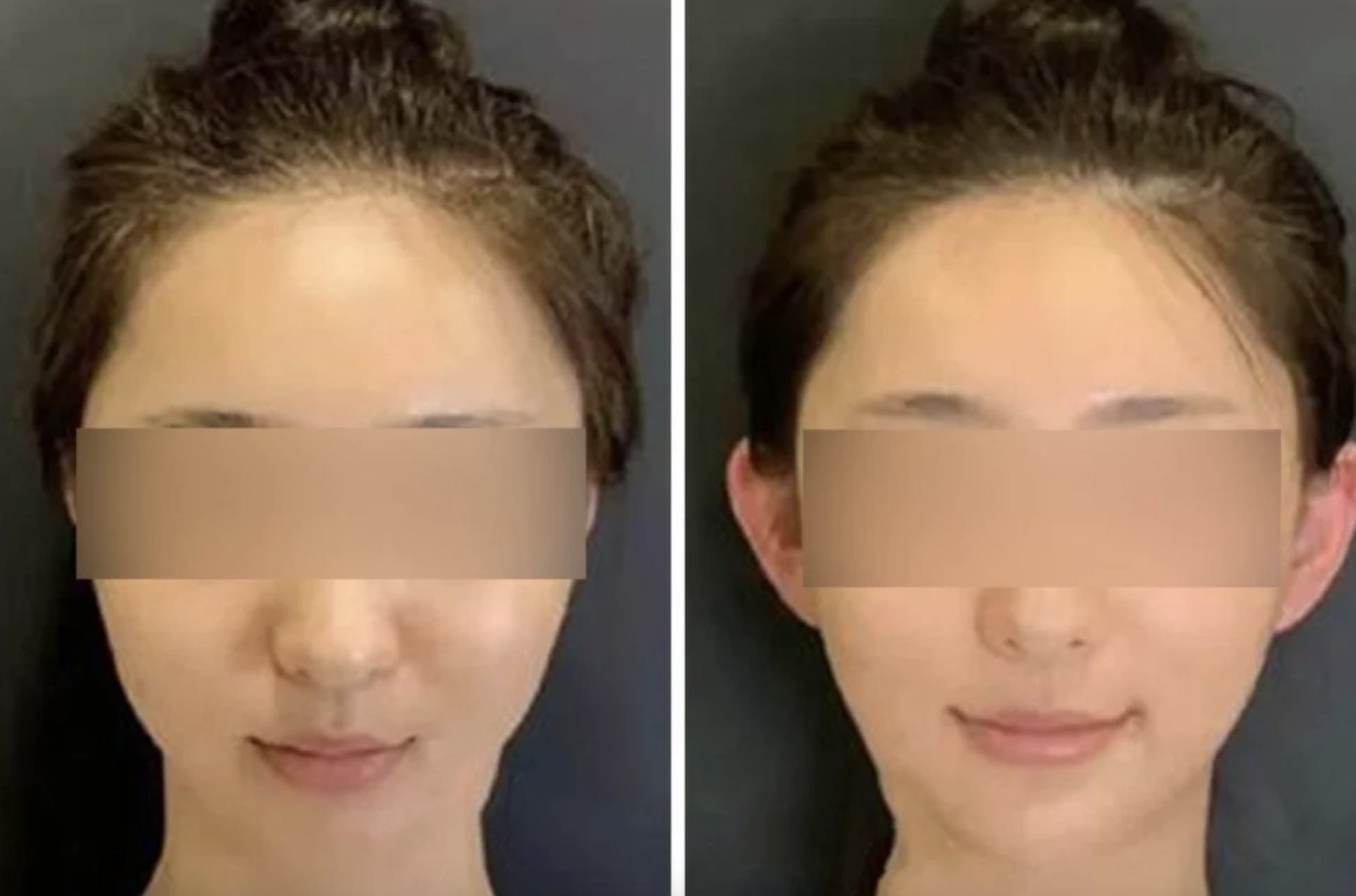 I ear you Having ‘Elf ears’ is a growing beauty craze among China’s